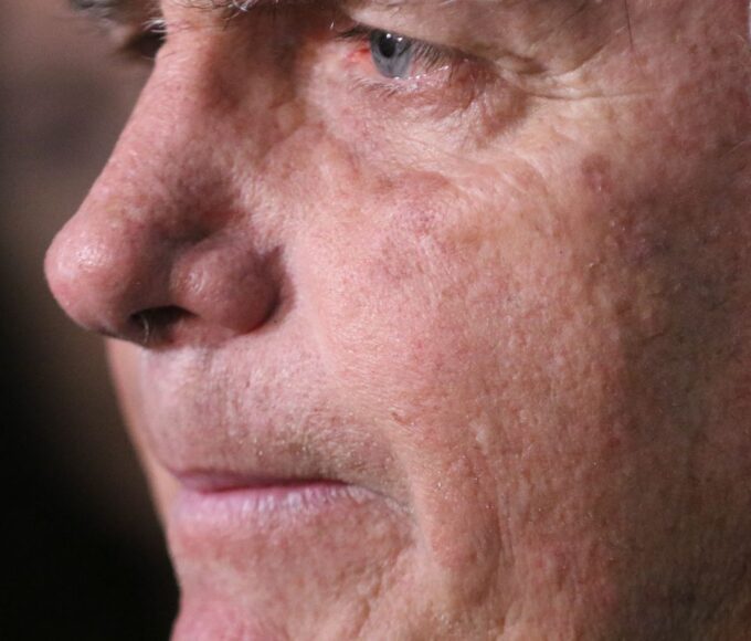 Com crise persistente de soluços, Bolsonaro faz nova cirurgia 12 trbr3411